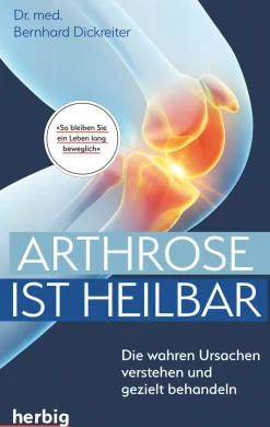 Arthrose ist heilbar