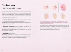 Diagnose Brustkrebs