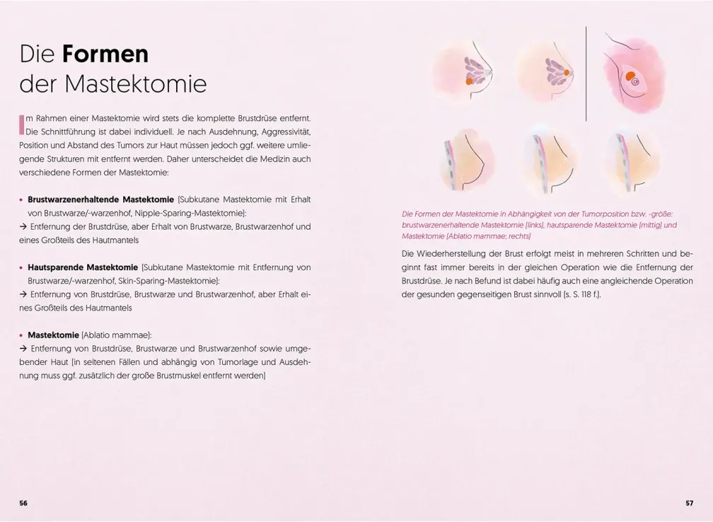 Diagnose Brustkrebs