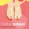 Hallux Valgus