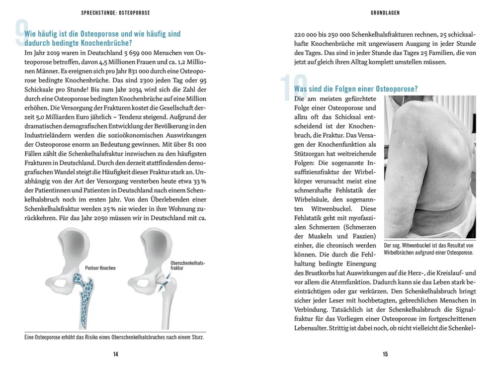 In der Sprechstunde: Osteoporose