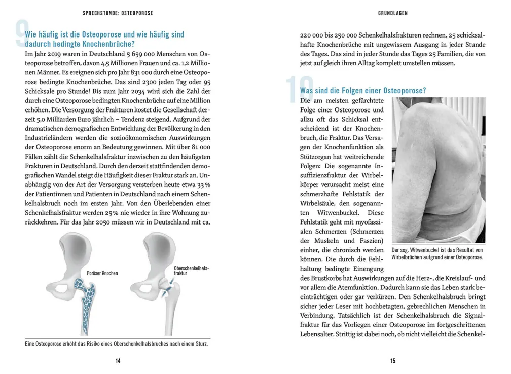 In der Sprechstunde: Osteoporose